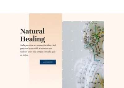 Acupuncture